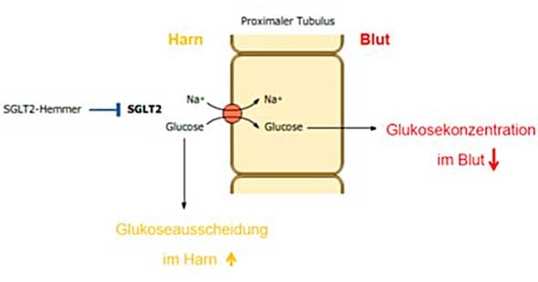 Hemmung der Glukoserückaufnahme vom Harn ins Blut im proximalen Tubulus der Niere durch SGLT-2-Hemmer.